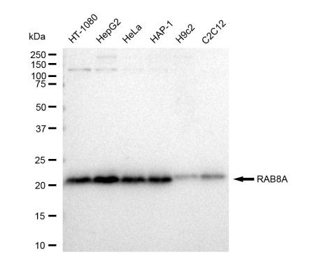 RAB8A Antibody in Western Blot (WB)