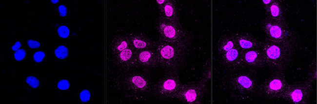 Fyn Antibody in Immunocytochemistry (ICC/IF)