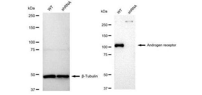 Androgen Receptor Antibody