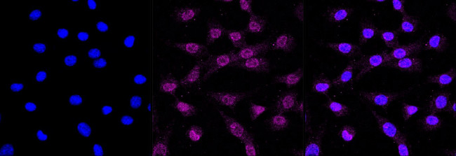 Cdc73 Antibody in Immunocytochemistry (ICC/IF)