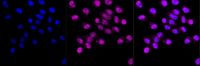 CD147 Antibody in Immunocytochemistry (ICC/IF)