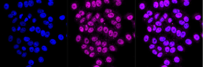 ATG5 Antibody in Immunocytochemistry (ICC/IF)