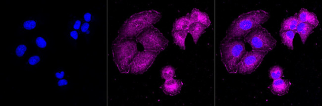 MTAP Antibody in Immunocytochemistry (ICC/IF)