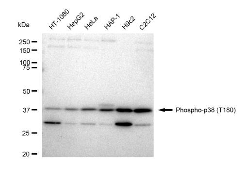 Phospho-p38 MAPK (Thr180) Antibody in Western Blot (WB)
