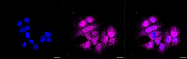 CDK4 Antibody in Immunocytochemistry (ICC/IF)