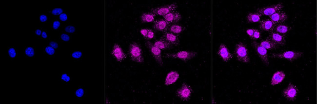 ABH1 Antibody in Immunocytochemistry (ICC/IF)