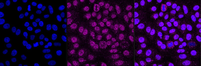 beta Arrestin 1 Antibody in Immunocytochemistry (ICC/IF)