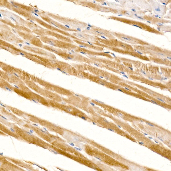 CD273 (B7-DC) Antibody in Immunohistochemistry (Paraffin) (IHC (P))