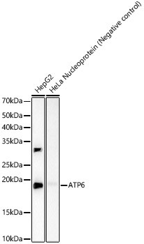 MT-ATP6 Antibody in Western Blot (WB)