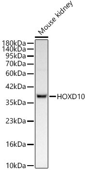 HOXD10 Antibody in Western Blot (WB)