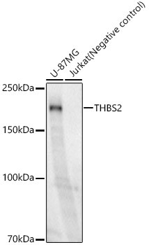 Thrombospondin 2 Antibody in Western Blot (WB)