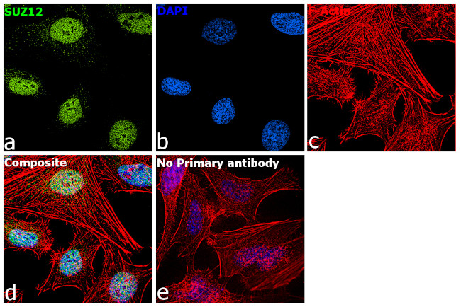 SUZ12 Antibody in Immunocytochemistry (ICC/IF)