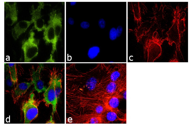 CDK5 Antibody in Immunocytochemistry (ICC/IF)