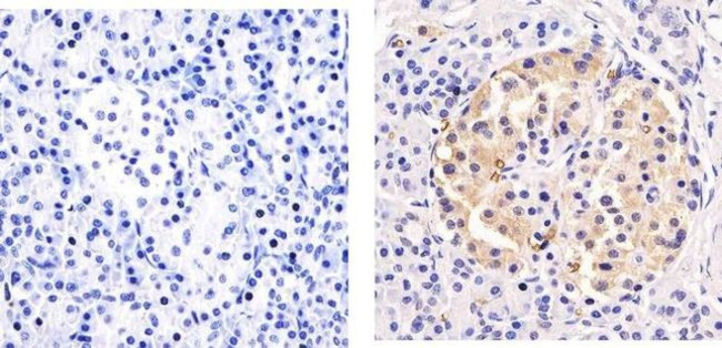 GLUT1 Antibody in Immunohistochemistry (Paraffin) (IHC (P))