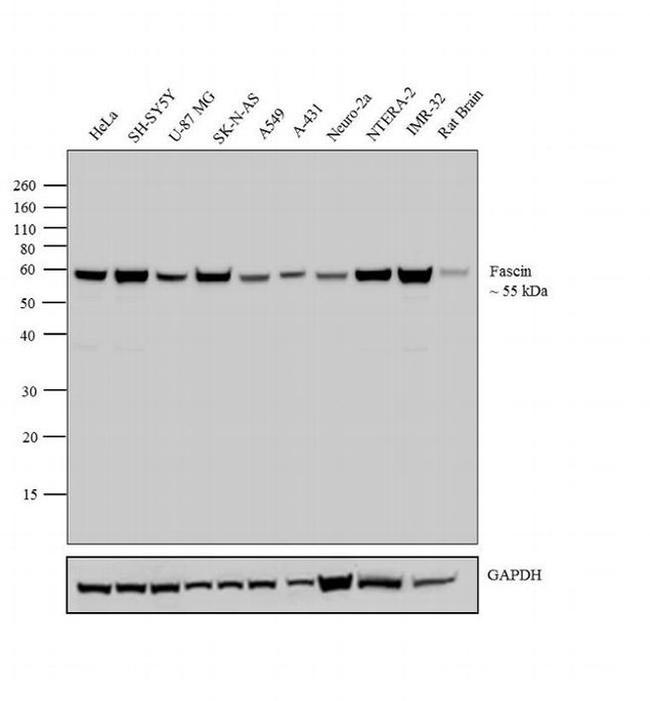 Fascin Antibody in Western Blot (WB)