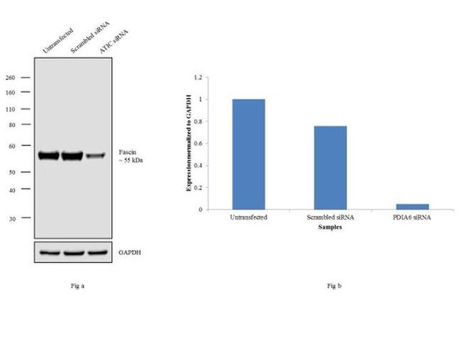 Fascin Antibody in Western Blot (WB)