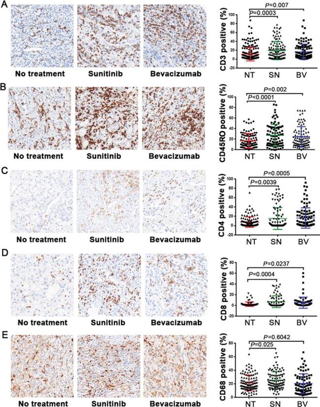 CD45RO Antibody in Immunohistochemistry (IHC)