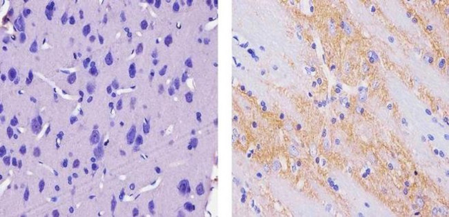 Synaptophysin Monoclonal Antibody (SYP02) (MA5-11575)