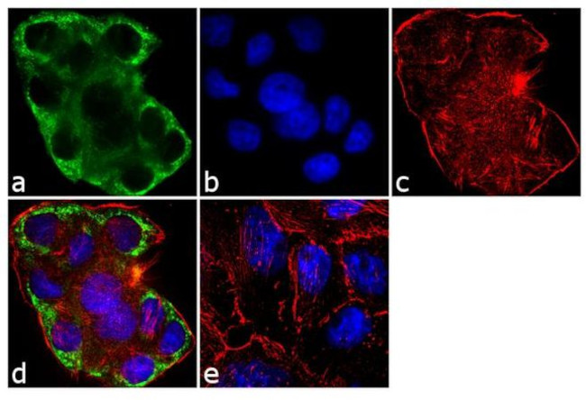 Cytokeratin 14 Antibody in Immunocytochemistry (ICC/IF)