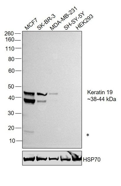 Cytokeratin 19 Antibody