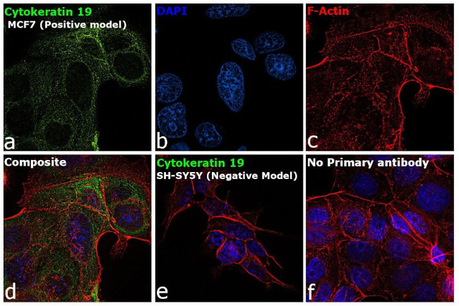 Cytokeratin 19 Antibody in Immunocytochemistry (ICC/IF)