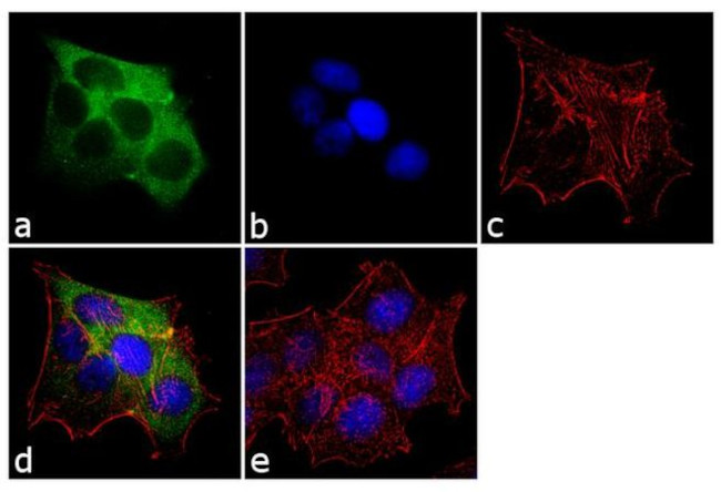 Cytokeratin 19 Antibody in Immunocytochemistry (ICC/IF)