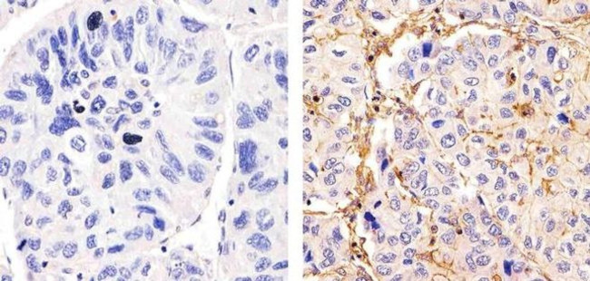 MUC3 Antibody in Immunohistochemistry (Paraffin) (IHC (P))