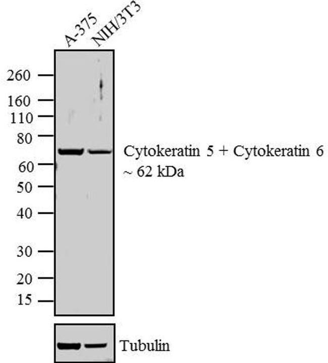 Cytokeratin 5/6 Antibody in Western Blot (WB)