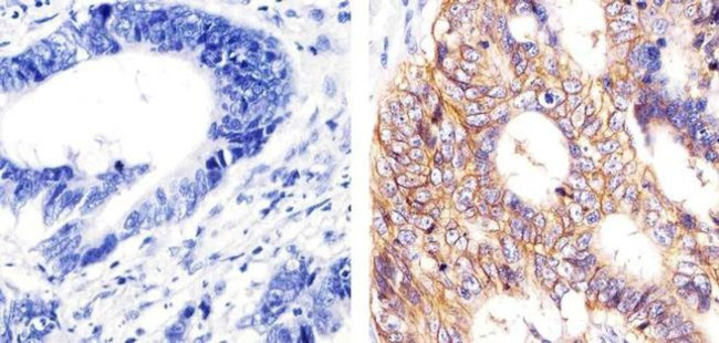 EpCAM Antibody in Immunohistochemistry (Paraffin) (IHC (P))