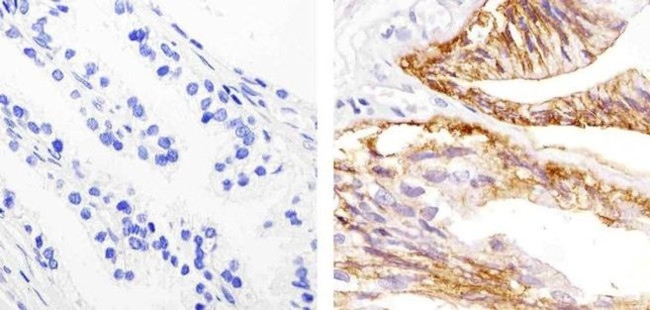 EpCAM Antibody in Immunohistochemistry (Paraffin) (IHC (P))