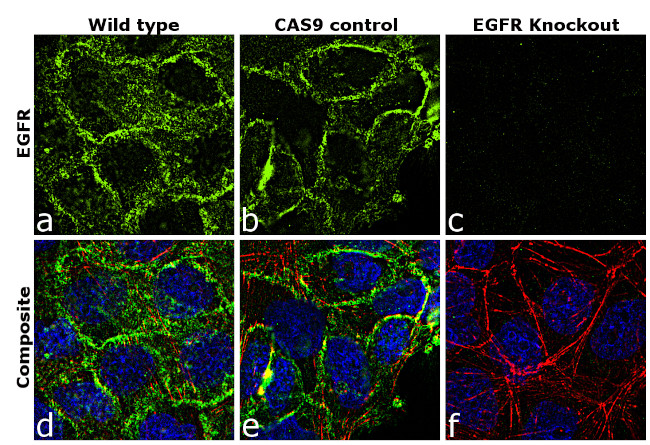 EGFR Antibody in Immunocytochemistry (ICC/IF)