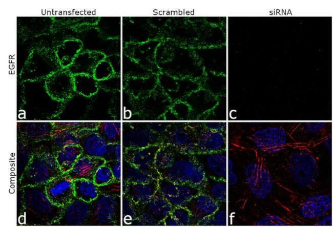 EGFR Antibody