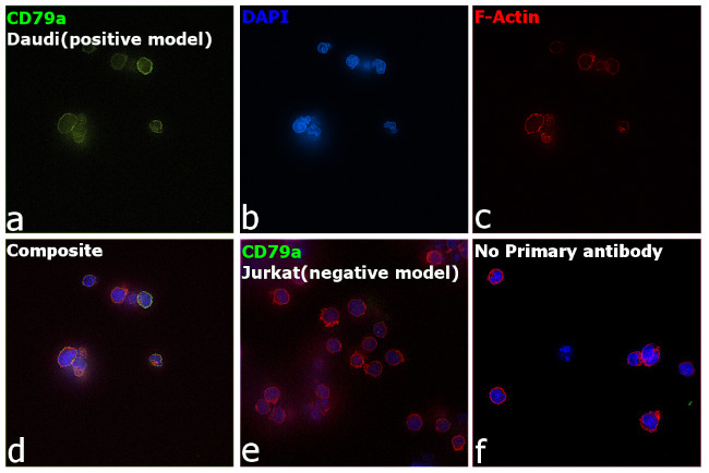 CD79a Antibody in Immunocytochemistry (ICC/IF)