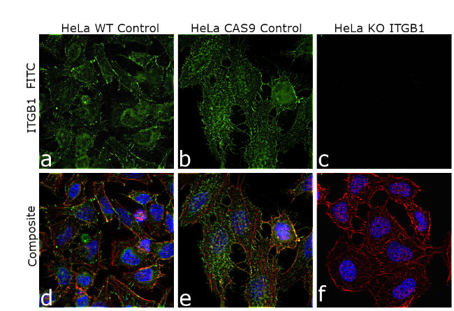 ITGB1 Antibody in Immunocytochemistry (ICC/IF)