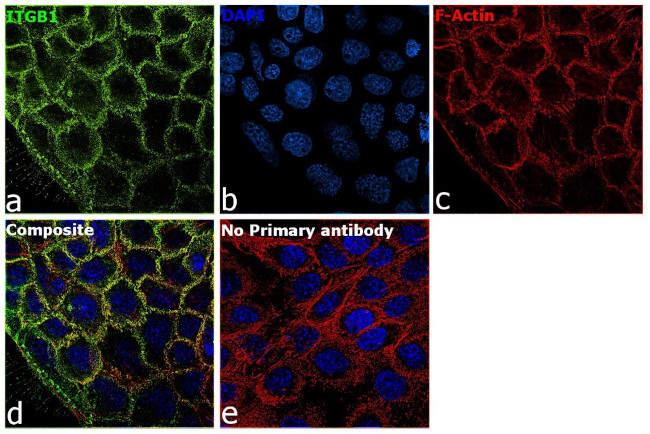 ITGB1 Antibody in Immunocytochemistry (ICC/IF)