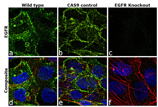 EGFR Antibody in Immunocytochemistry (ICC/IF)