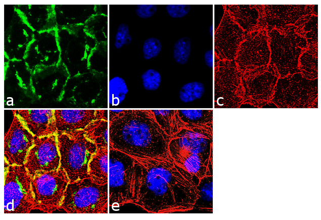 EGFR Antibody in Immunocytochemistry (ICC/IF)