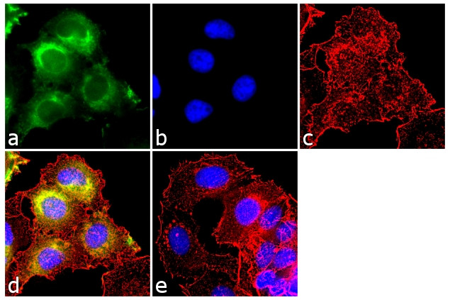 Cdc25A Antibody in Immunocytochemistry (ICC/IF)