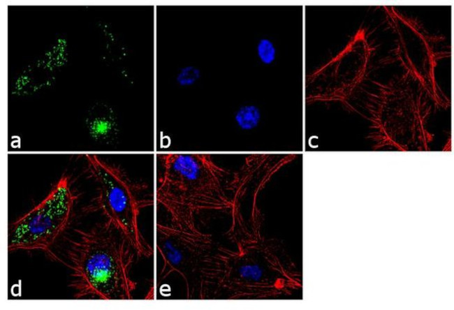 VWF Antibody in Immunocytochemistry (ICC/IF)