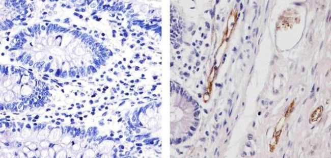 VWF Antibody in Immunohistochemistry (Paraffin) (IHC (P))