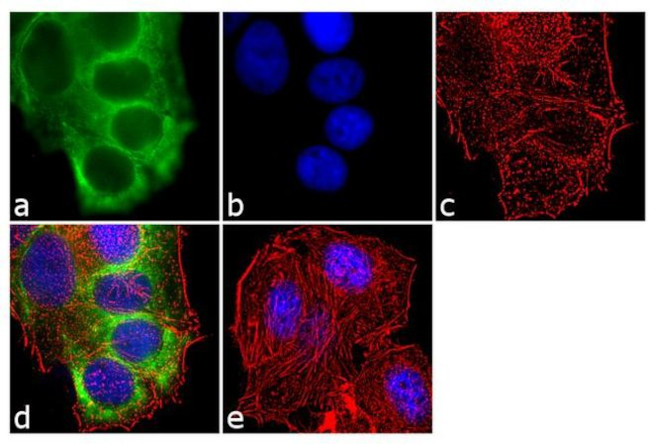 Cytokeratin 8/18 Antibody in Immunocytochemistry (ICC/IF)