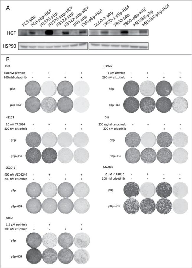 HGF Antibody in Western Blot (WB)