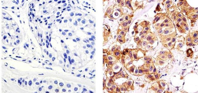 E-cadherin Antibody in Immunohistochemistry (Paraffin) (IHC (P))