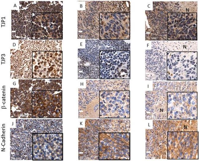 beta Catenin Antibody in Immunohistochemistry (Paraffin) (IHC (P))