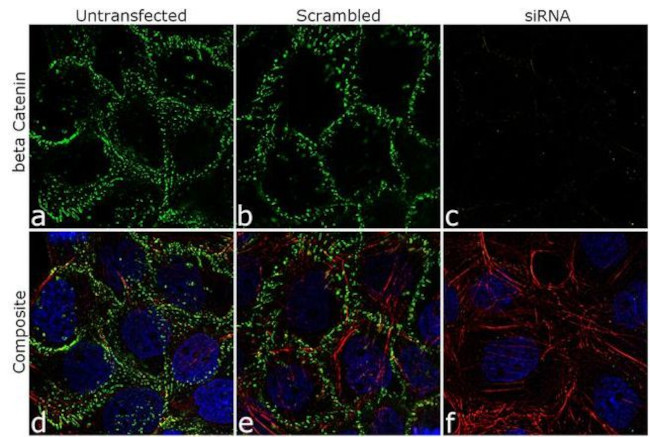 beta Catenin Antibody