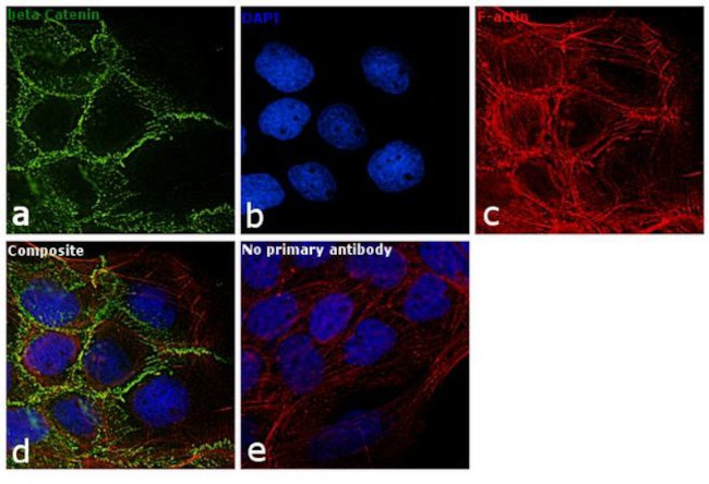 beta Catenin Antibody in Immunocytochemistry (ICC/IF)