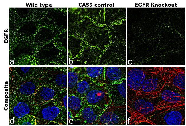 Phospho-EGFR (Tyr1068) Antibody in Immunocytochemistry (ICC/IF)