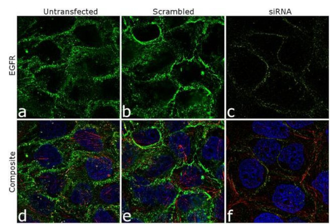 Phospho-EGFR (Tyr1068) Antibody in Immunocytochemistry (ICC/IF)