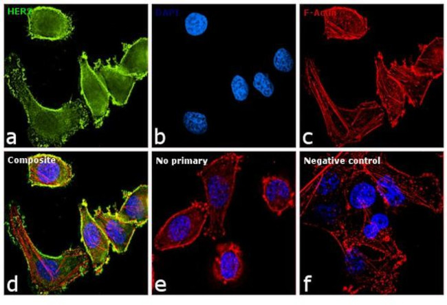 ErbB2 (HER-2) Antibody