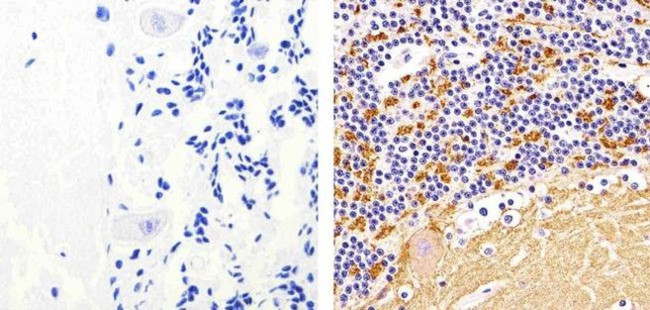 Synaptophysin Antibody in Immunohistochemistry (Paraffin) (IHC (P))